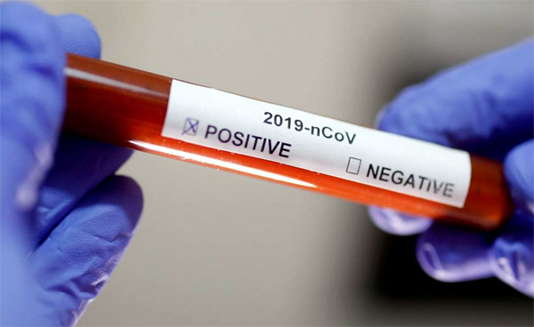 Vaksin Covid-19 Diperkirakan November Akan Datang, Pemerintah Sertakan MUI