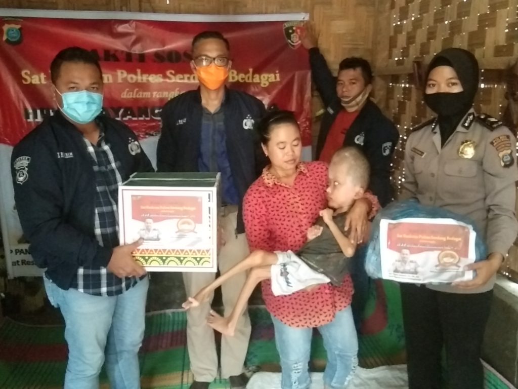 HUT Bhayangkara, Sat Reskrim  Polres Sergai Bantu Penderita Hidrosefalus