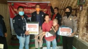 HUT Bhayangkara, Sat Reskrim  Polres Sergai Bantu Penderita Hidrosefalus
