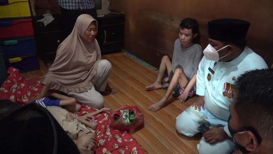 Dua Bersaudara Penderita Gizi Buruk di Tanjungbalai