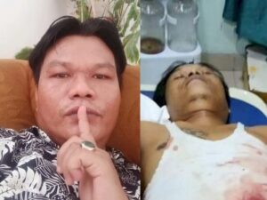Soal Penembakan Wartawan di Simalungun, Polda Sumut Periksa 34 Saksi
